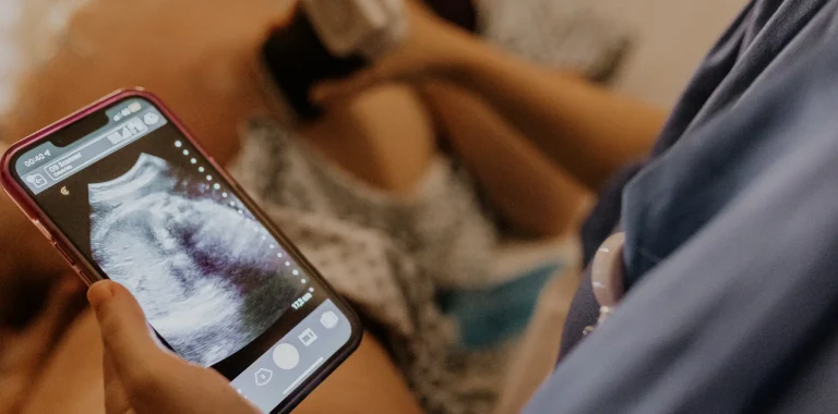 imagem post Quais são os ultrassons mais importantes da gravidez?